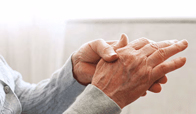 Arthritis in den Händen